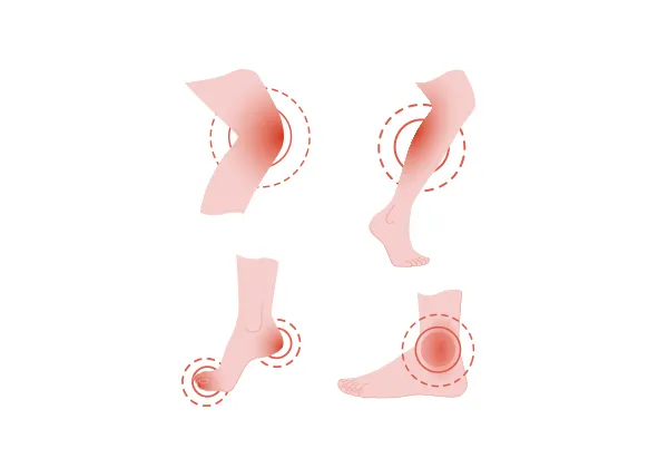 Lower-limb Knowhow